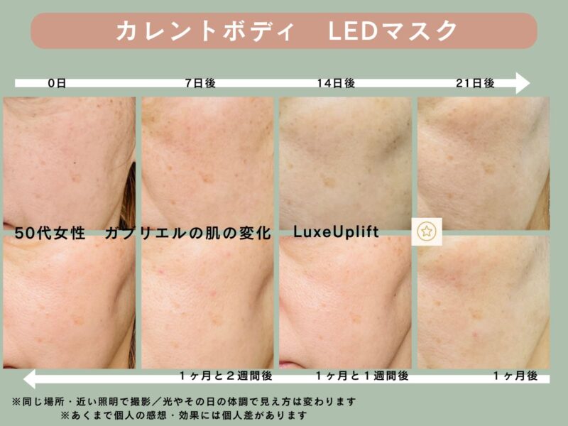 カレントボディLEDマスクを使った50代女性の左頬の変化記録。0日・7日後・14日後・21日後・1ヶ月後・1ヶ月と1週間後・1ヶ月と2週間後のビフォーアフター写真