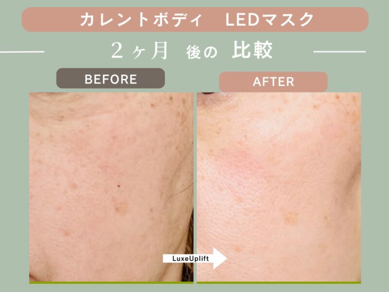 カレントボディLEDマスクを2ヶ月使用した50代の左頬ビフォーアフター。シミは残るが肌全体が明るい印象に（個人の感想）
