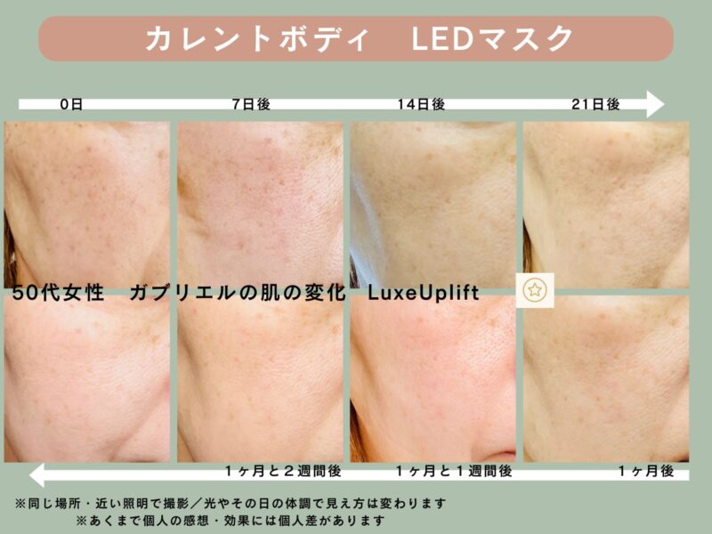 カレントボディLEDマスクを使った50代女性の右頬の変化記録。0日・7日後・14日後・21日後・1ヶ月後・1ヶ月と1週間後・1ヶ月と2週間後のビフォーアフター写真