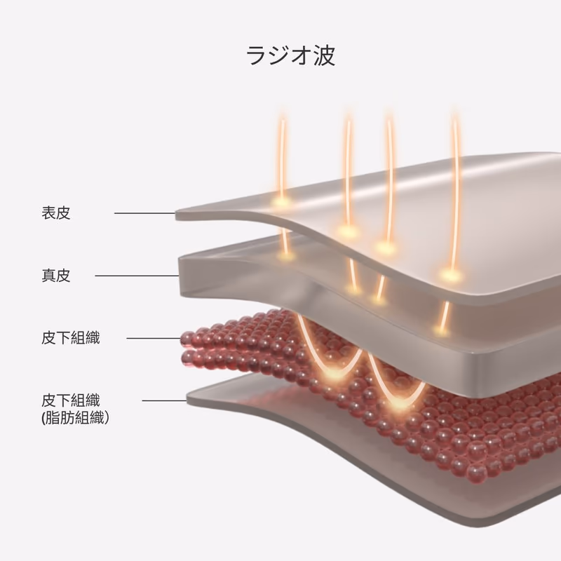 出典:カレントボディ